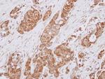 ALS2CR1 Polyclonal Antibody
