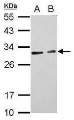 CIDEC Antibody in Western Blot (WB)