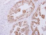 RBKS Polyclonal Antibody