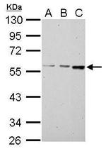 MCCC2 Antibody in Western Blot (WB)