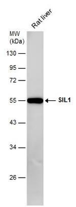 SIL1 Antibody in Western Blot (WB)