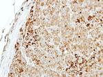 MTMR14 Antibody in Immunohistochemistry (Paraffin) (IHC (P))