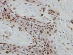 POLR1E Polyclonal Antibody