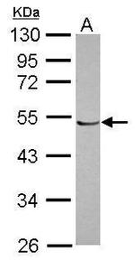 POLR1E Antibody in Western Blot (WB)
