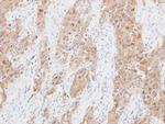 MRPL1 Antibody in Immunohistochemistry (Paraffin) (IHC (P))