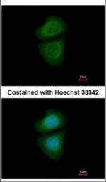 WDR77 Polyclonal Antibody