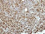 ZNF426 Polyclonal Antibody
