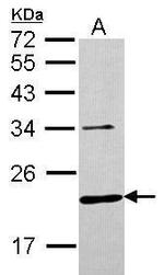 CHMP6 Polyclonal Antibody