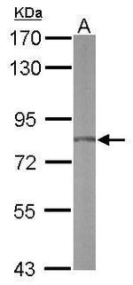 RPAP3 Antibody in Western Blot (WB)