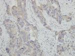 HSPBAP1 Polyclonal Antibody