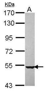 NPEPL1 Antibody in Western Blot (WB)