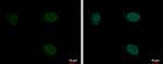 PYGO2 Polyclonal Antibody