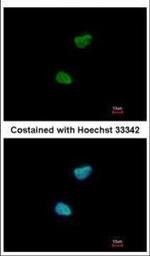 NEK11 Polyclonal Antibody