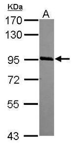 PHF17 Antibody in Western Blot (WB)