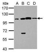 C17orf70 Polyclonal Antibody