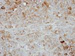 Nectin 4 Polyclonal Antibody