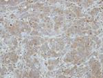 ITM2C Polyclonal Antibody