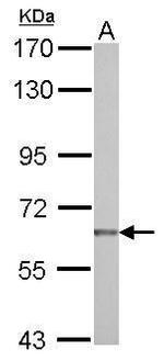NUAK2 Antibody in Western Blot (WB)