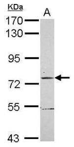 TRIM56 Antibody in Western Blot (WB)