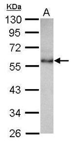 CHST9 Antibody in Western Blot (WB)