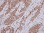 TEKT1 Polyclonal Antibody