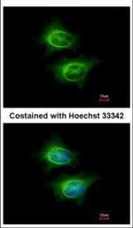 ASCC2 Polyclonal Antibody
