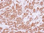 ASCC2 Antibody in Immunohistochemistry (Paraffin) (IHC (P))