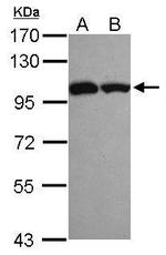 ASCC2 Antibody in Western Blot (WB)