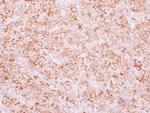 TEM8 Polyclonal Antibody