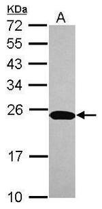 C1orf57 Antibody in Western Blot (WB)