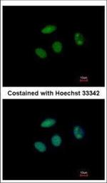 PHF6 Polyclonal Antibody