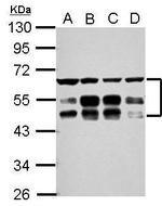 ZFYVE19 Polyclonal Antibody