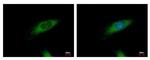 HIP1R Polyclonal Antibody