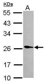 PLA2G12A Antibody in Western Blot (WB)