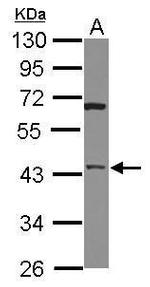 HTRA3 Polyclonal Antibody