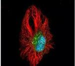 Tankyrase Antibody in Immunocytochemistry (ICC/IF)