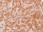 Tankyrase Antibody in Immunohistochemistry (Paraffin) (IHC (P))