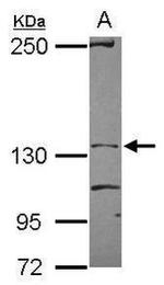 Tankyrase Antibody in Western Blot (WB)