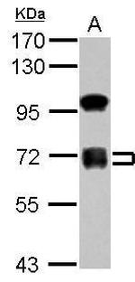 ZNF182 Polyclonal Antibody