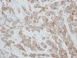 CYP3A43 Antibody in Immunohistochemistry (Paraffin) (IHC (P))
