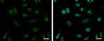 ZNF189 Polyclonal Antibody