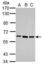 ZNF189 Antibody in Western Blot (WB)