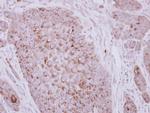 ZP2 Polyclonal Antibody