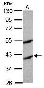 MOGAT2 Polyclonal Antibody