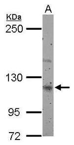 Munc13-4 Polyclonal Antibody