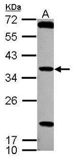TSSK4 Antibody in Western Blot (WB)