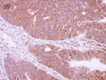 NRBP2 Polyclonal Antibody
