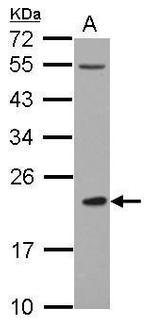 CLEC4A Antibody in Western Blot (WB)