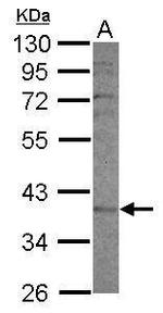 CYP2F1 Polyclonal Antibody