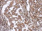 LAX1 Polyclonal Antibody